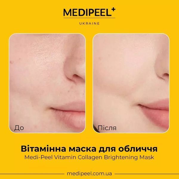 Витаминная маска для лица Medi-Peel Vitamin Collagen Brightening Mask 1 шт 2381575533 фото